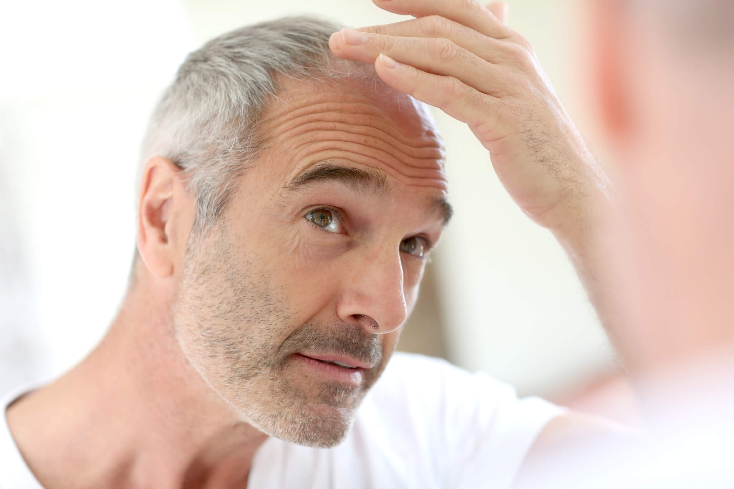 mens hair loss